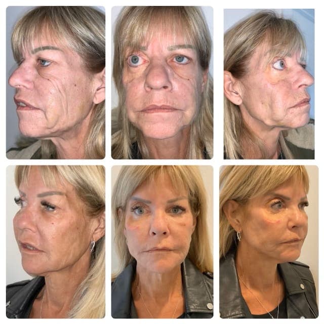 Aesthetic Treatments South Yorkshire